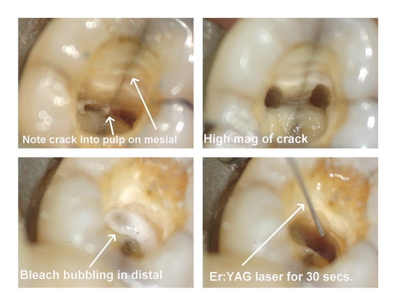 CM endo pg 6_resize.jpg